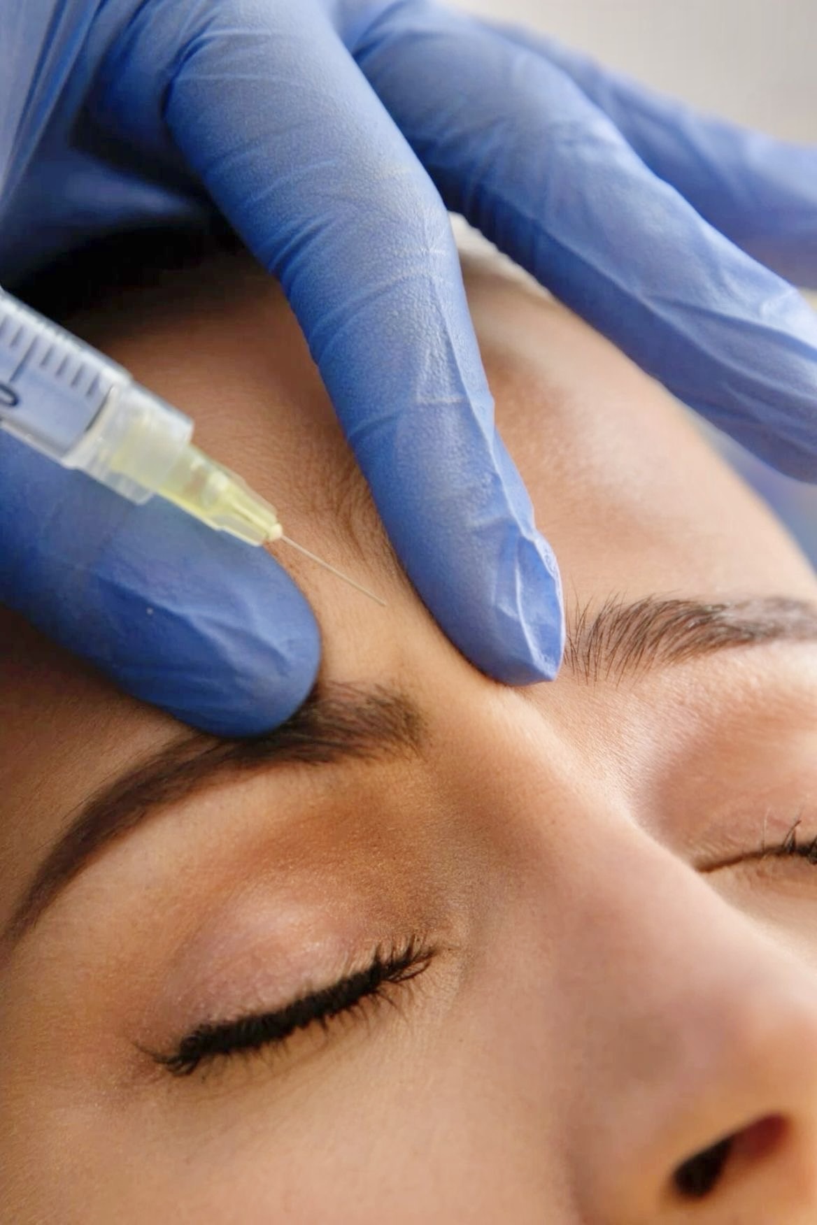 Rostro natural después de tratamiento con toxina botulínica